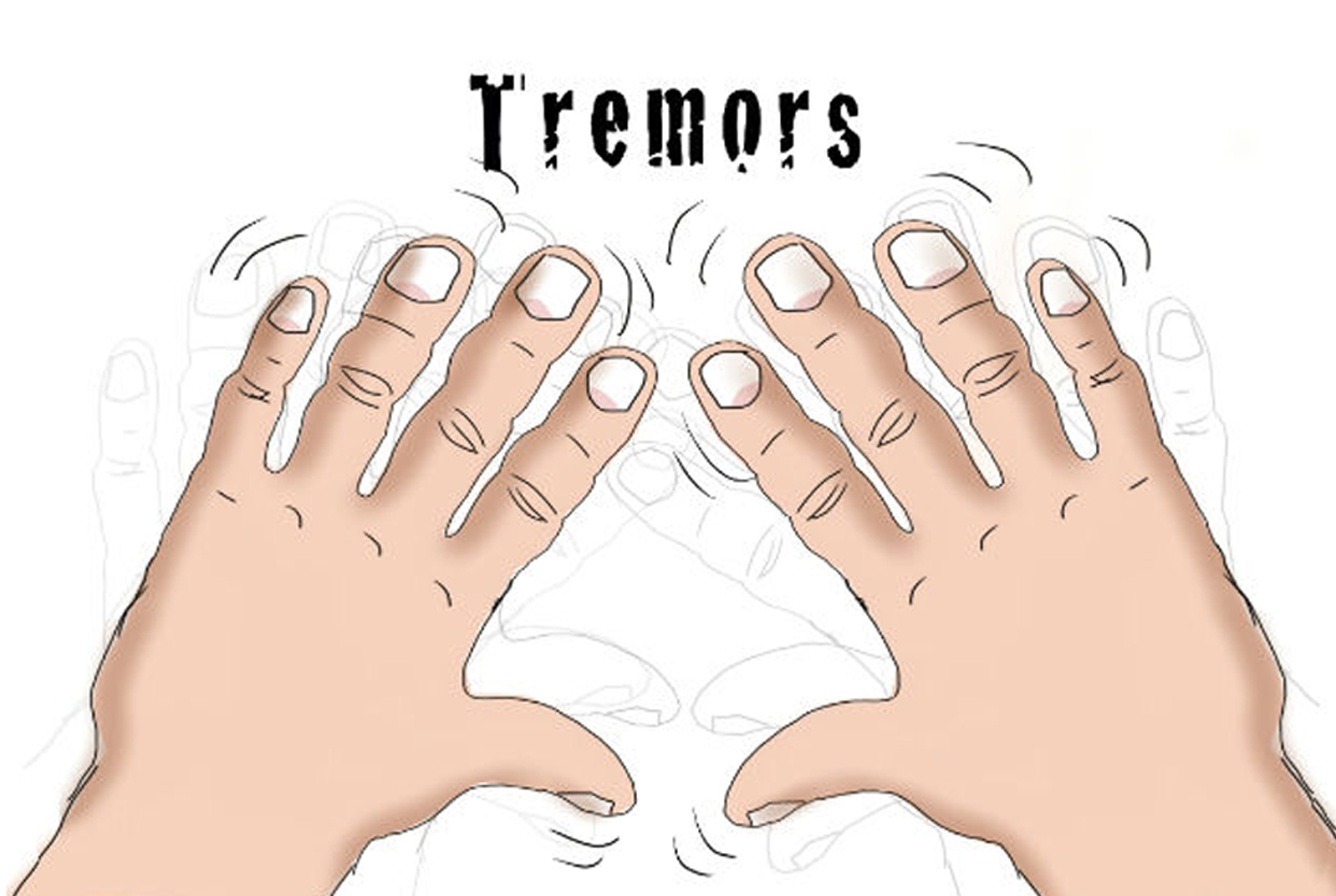 Tremor