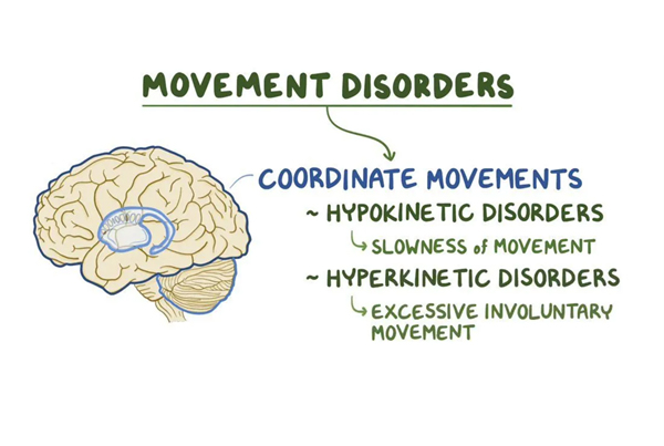 Movement Disorder